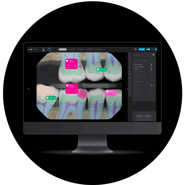 invisalign-woking-dentla